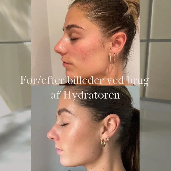 Produktbillede 2